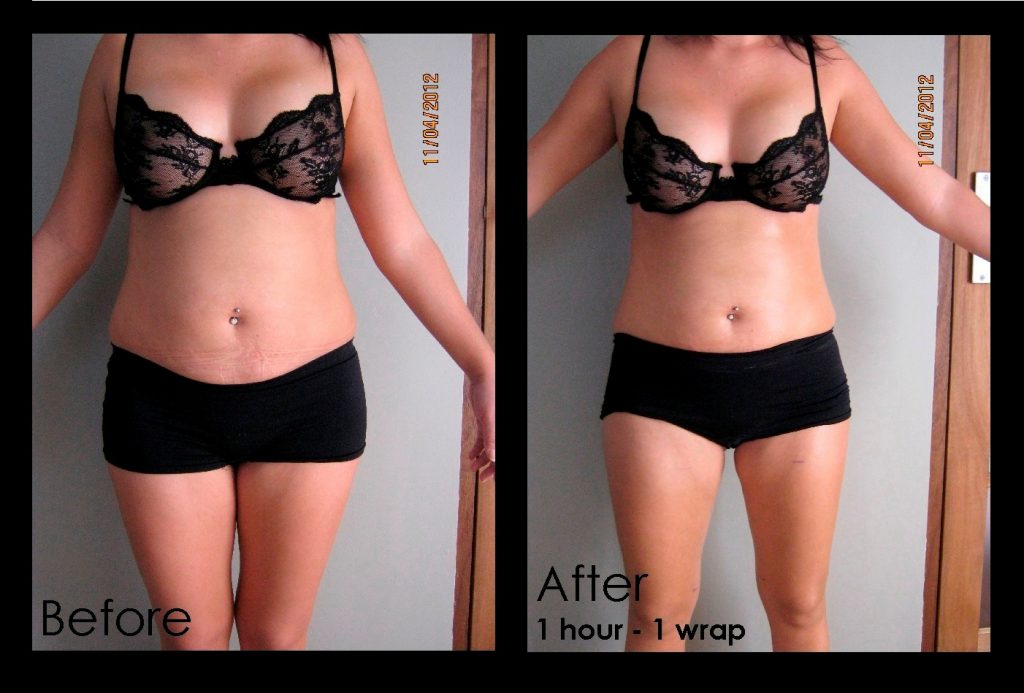 trattamento snellente bioslimming