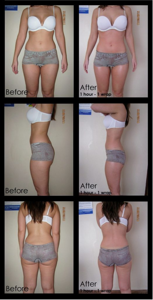trattamento snellente bioslimming