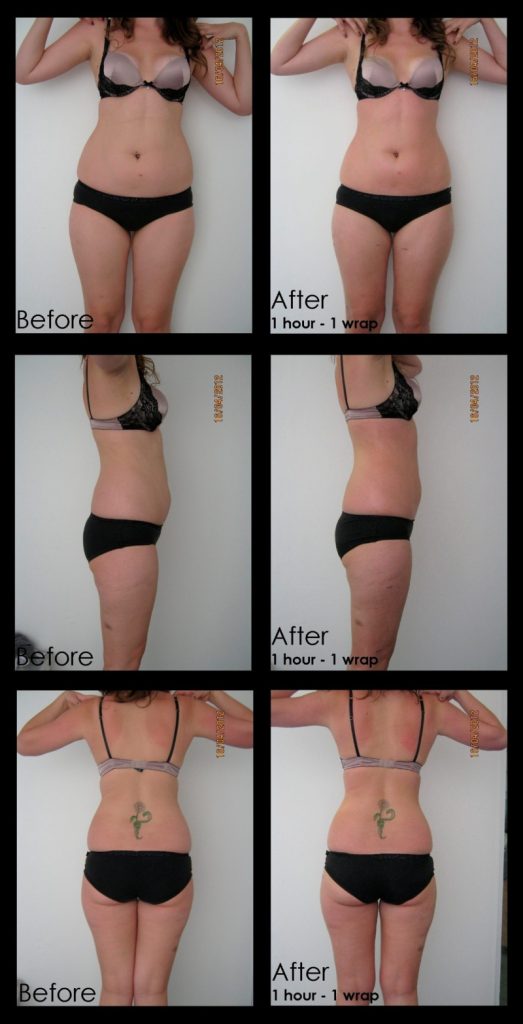 trattamento snellente bioslimming